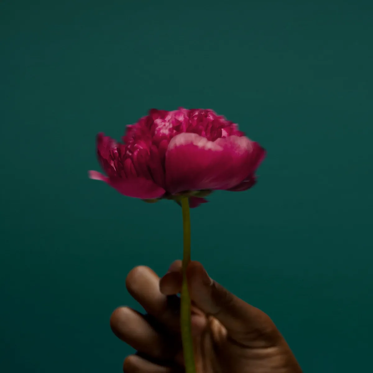 İmplant tedavi vakası 3